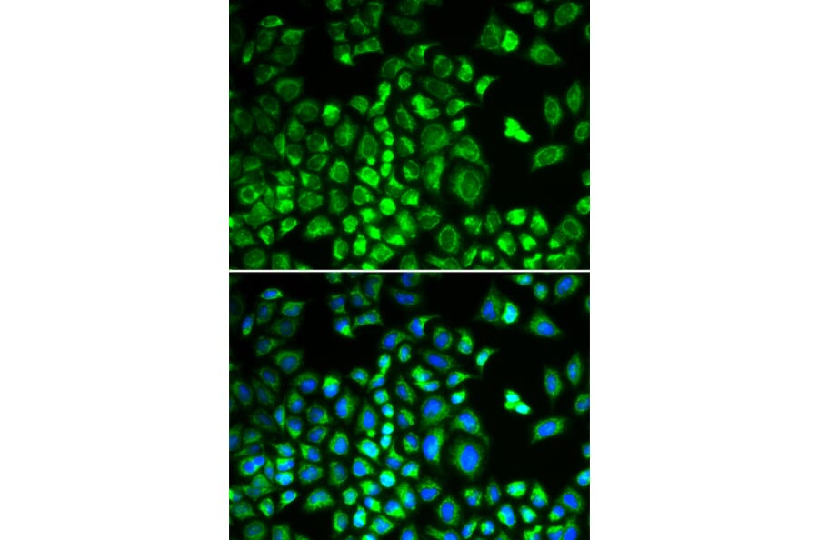Immunofluorescence - Anti-HAX1 Antibody (A14832) - Antibodies.com