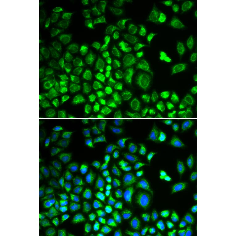 Immunofluorescence - Anti-HAX1 Antibody (A14832) - Antibodies.com