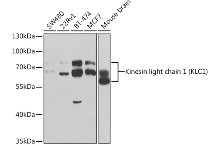 Western Blot - Anti-KLC1 Antibody (A14833) - Antibodies.com