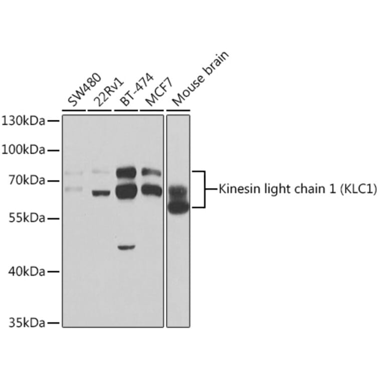 Western Blot - Anti-KLC1 Antibody (A14833) - Antibodies.com