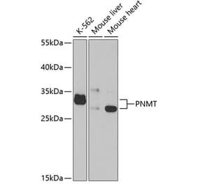 Western Blot - Anti-PNMT Antibody (A14834) - Antibodies.com