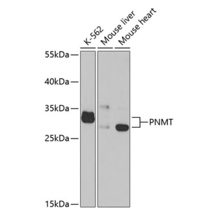 Western Blot - Anti-PNMT Antibody (A14834) - Antibodies.com