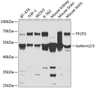 Western blot analysis of extracts of various cell lines, using Anti-TFCP2 Antibody (A5555) at 1:1,000 dilution. Secondary antibody: Goat Anti-Rabbit IgG (H+L) (HRP) (AS014) at 1:10,000 dilution. Lysates / proteins: 25µg per lane. Blocking buffer: 3% non-fat dry milk in TBST. Detection: ECL Basic Kit (RM00020). Exposure time: 5s.