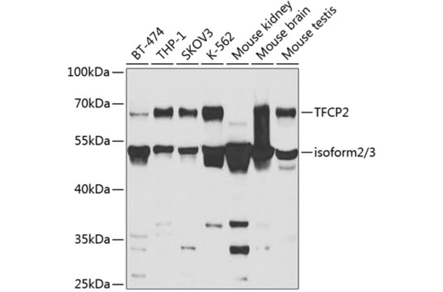 Western Blot - Anti-CP2c Antibody (A14836) - Antibodies.com