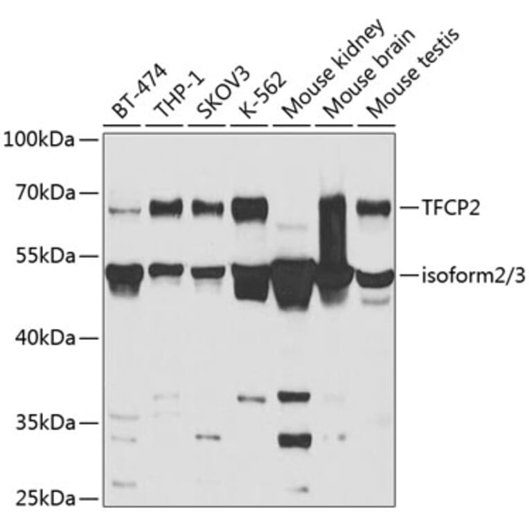 Western Blot - Anti-CP2c Antibody (A14836) - Antibodies.com