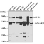 Western Blot - Anti-CP2c Antibody (A14836) - Antibodies.com