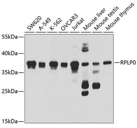 Western Blot - Anti-RPLP0 Antibody (A14838) - Antibodies.com