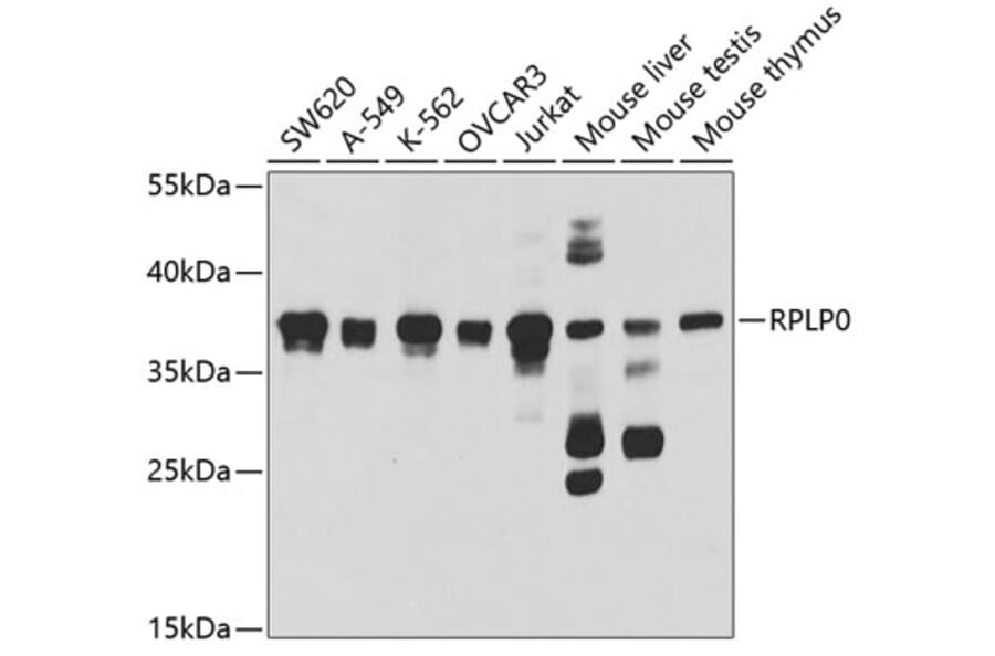 Western Blot - Anti-RPLP0 Antibody (A14838) - Antibodies.com