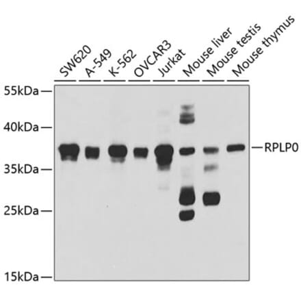 Western Blot - Anti-RPLP0 Antibody (A14838) - Antibodies.com