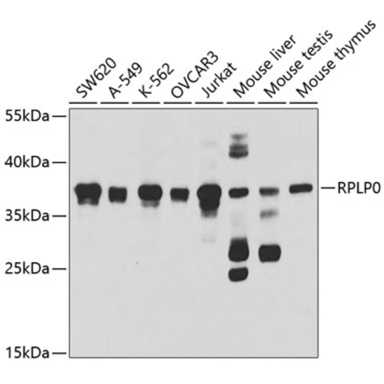 Western Blot - Anti-RPLP0 Antibody (A14838) - Antibodies.com