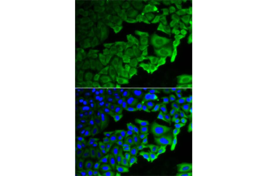 Immunofluorescence - Anti-RPLP0 Antibody (A14838) - Antibodies.com