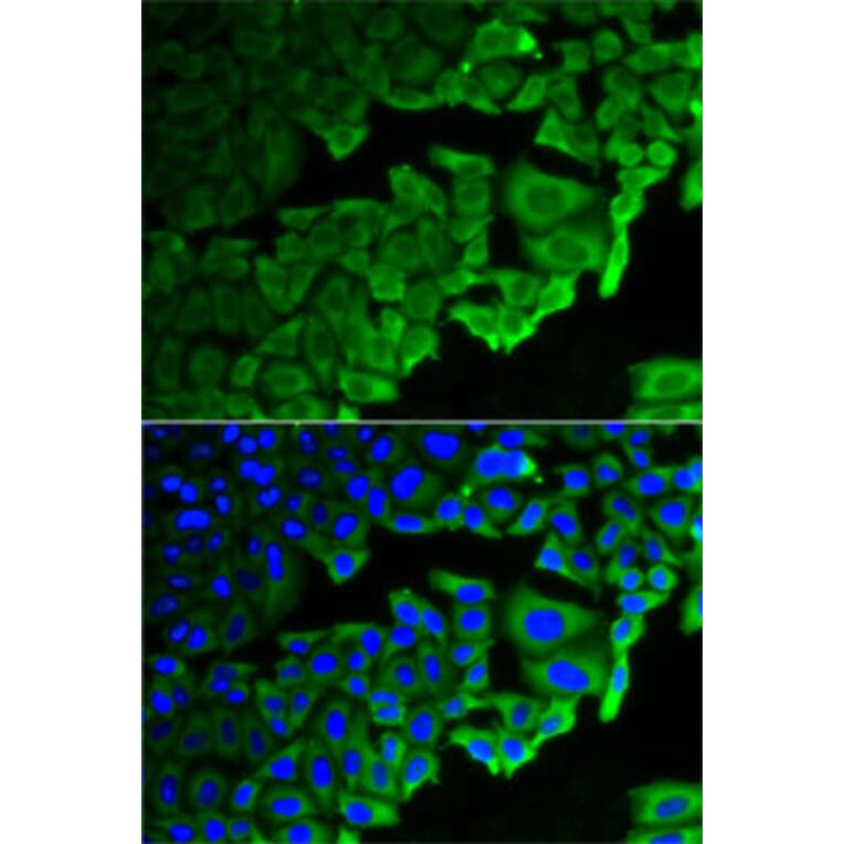 Immunofluorescence - Anti-RPLP0 Antibody (A14838) - Antibodies.com