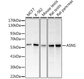 Western Blot - Anti-Asparagine synthetase Antibody (A14839) - Antibodies.com