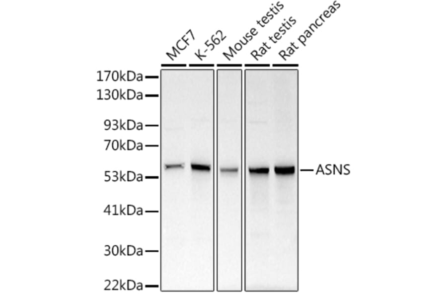 Western Blot - Anti-Asparagine synthetase Antibody (A14839) - Antibodies.com