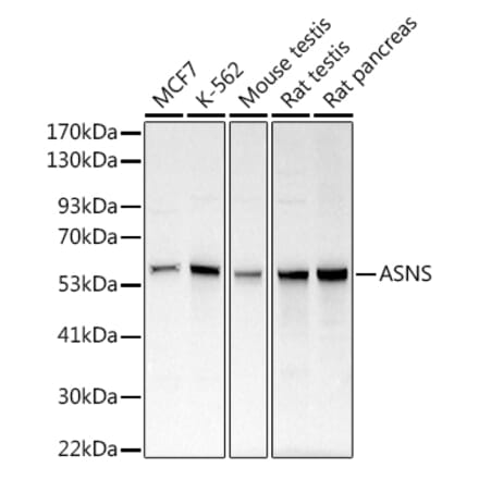 Western Blot - Anti-Asparagine synthetase Antibody (A14839) - Antibodies.com