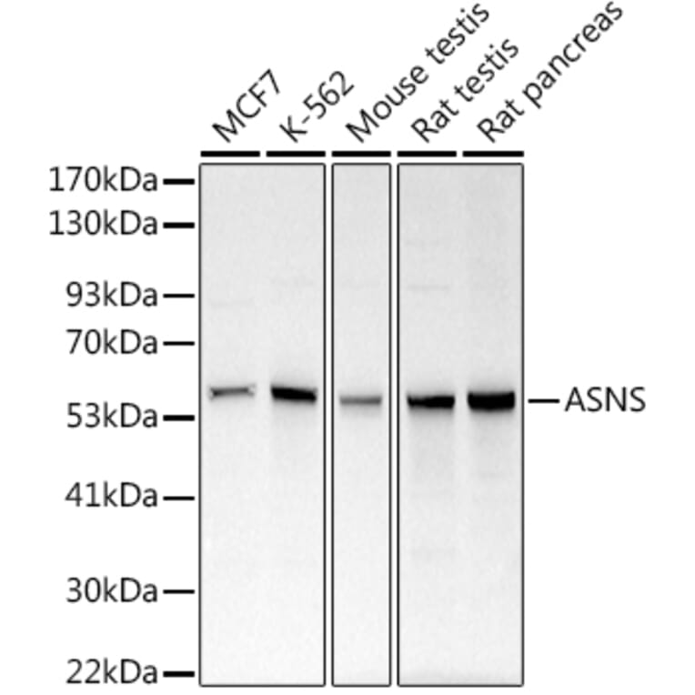 Western Blot - Anti-Asparagine synthetase Antibody (A14839) - Antibodies.com