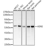 Western Blot - Anti-Asparagine synthetase Antibody (A14839) - Antibodies.com