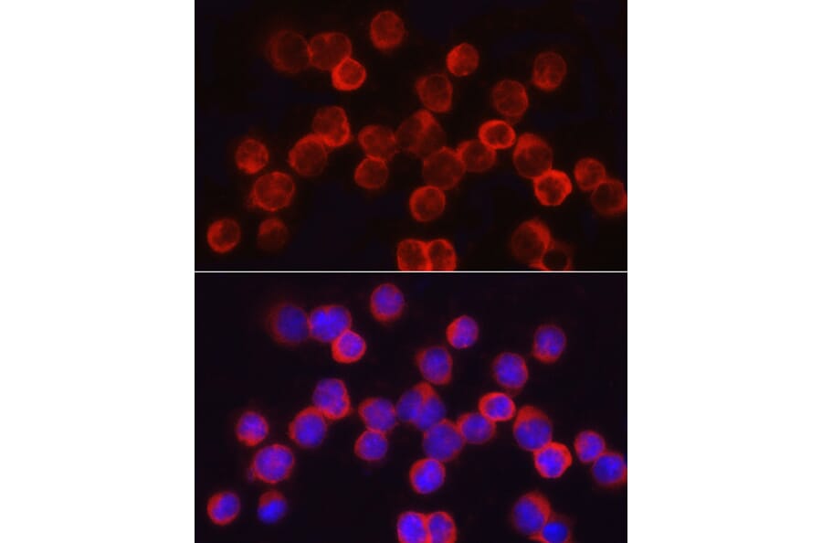 Immunofluorescence - Anti-Asparagine synthetase Antibody (A14839) - Antibodies.com