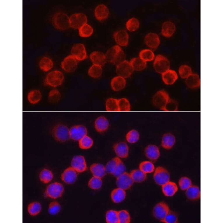 Immunofluorescence - Anti-Asparagine synthetase Antibody (A14839) - Antibodies.com