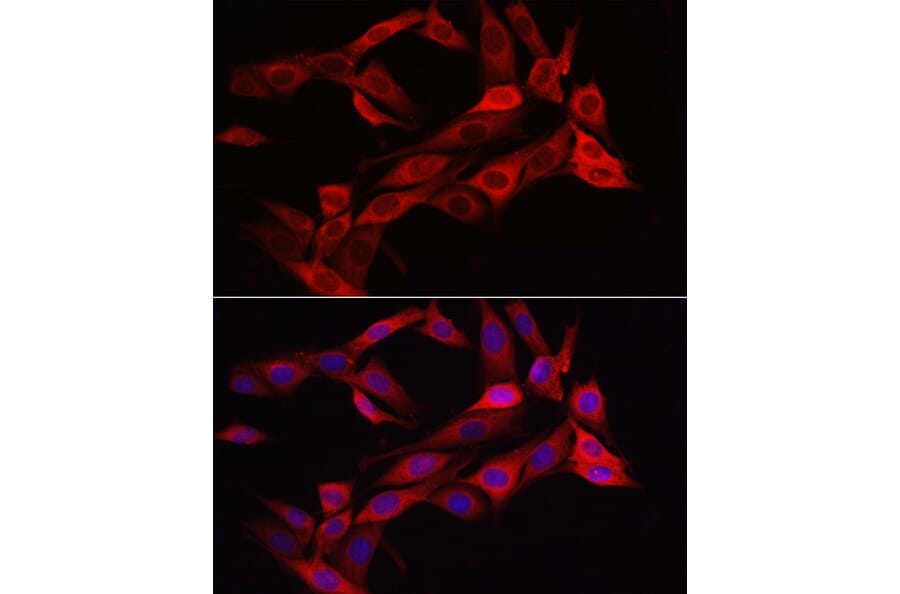 Immunofluorescence - Anti-Asparagine synthetase Antibody (A14839) - Antibodies.com