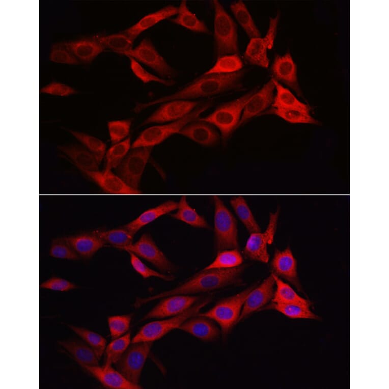 Immunofluorescence - Anti-Asparagine synthetase Antibody (A14839) - Antibodies.com