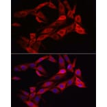Immunofluorescence - Anti-Asparagine synthetase Antibody (A14839) - Antibodies.com