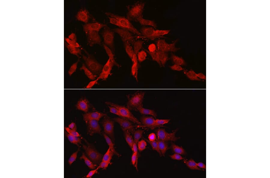 Immunofluorescence - Anti-Asparagine synthetase Antibody (A14839) - Antibodies.com