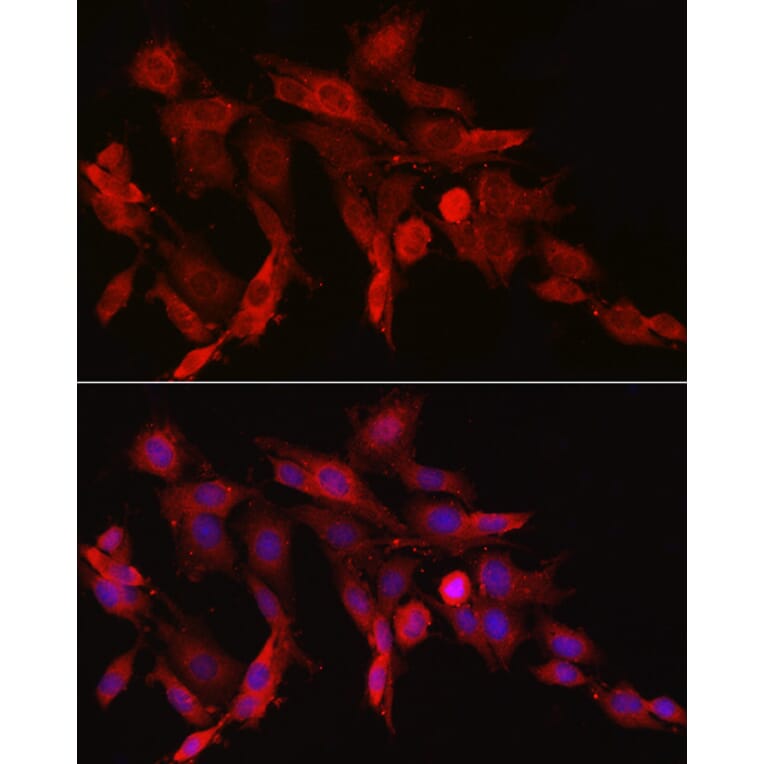 Immunofluorescence - Anti-Asparagine synthetase Antibody (A14839) - Antibodies.com