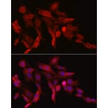 Immunofluorescence - Anti-Asparagine synthetase Antibody (A14839) - Antibodies.com