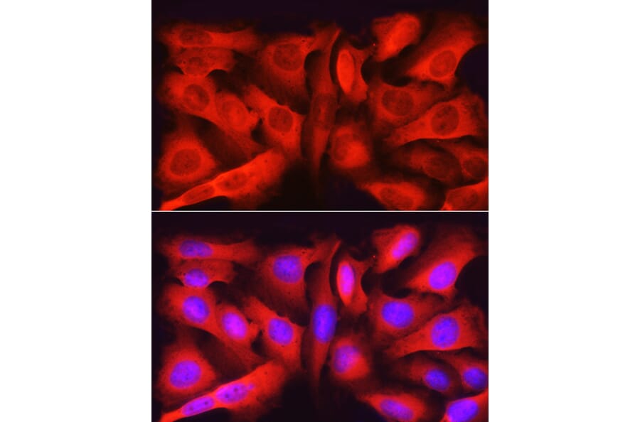 Immunofluorescence - Anti-Asparagine synthetase Antibody (A14839) - Antibodies.com