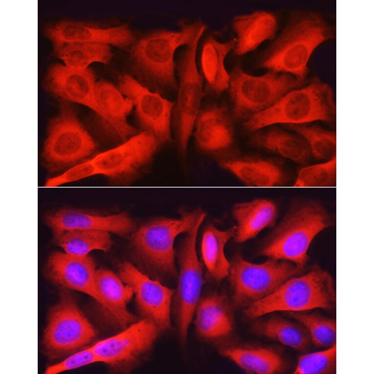 Immunofluorescence - Anti-Asparagine synthetase Antibody (A14839) - Antibodies.com