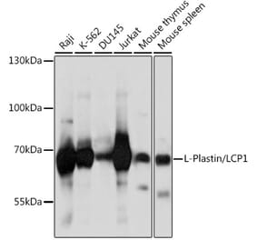 Western Blot - Anti-Plastin L Antibody (A14842) - Antibodies.com