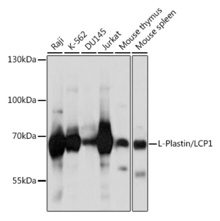 Western Blot - Anti-Plastin L Antibody (A14842) - Antibodies.com