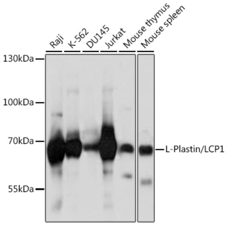 Western Blot - Anti-Plastin L Antibody (A14842) - Antibodies.com
