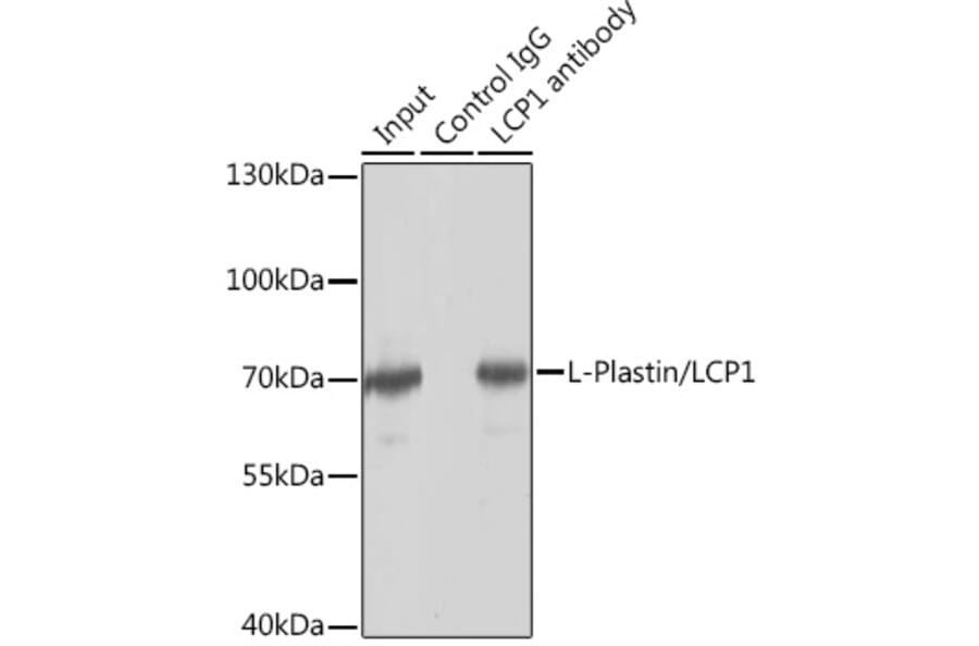Western Blot - Anti-Plastin L Antibody (A14842) - Antibodies.com