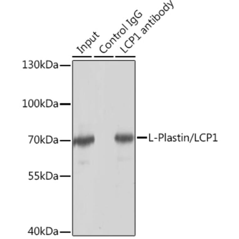Western Blot - Anti-Plastin L Antibody (A14842) - Antibodies.com