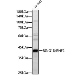 Western Blot - Anti-RING2 / RING1B / RNF2 Antibody (A14844) - Antibodies.com