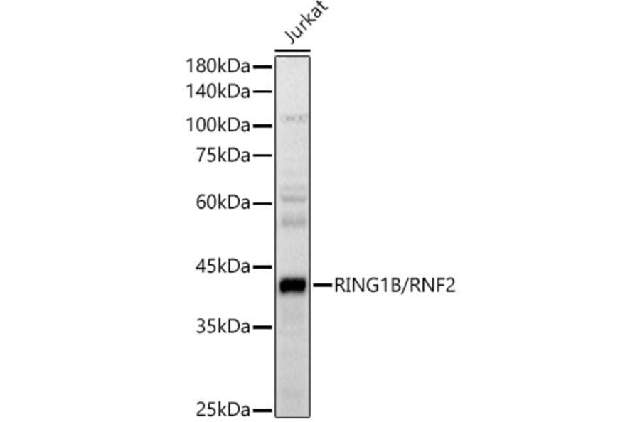 Western Blot - Anti-RING2/RING1B/RNF2 Antibody (A14844) - Antibodies.com