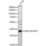 Western Blot - Anti-RING2/RING1B/RNF2 Antibody (A14844) - Antibodies.com