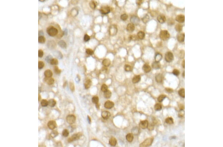 Immunohistochemistry - Anti-RING2/RING1B/RNF2 Antibody (A14844) - Antibodies.com