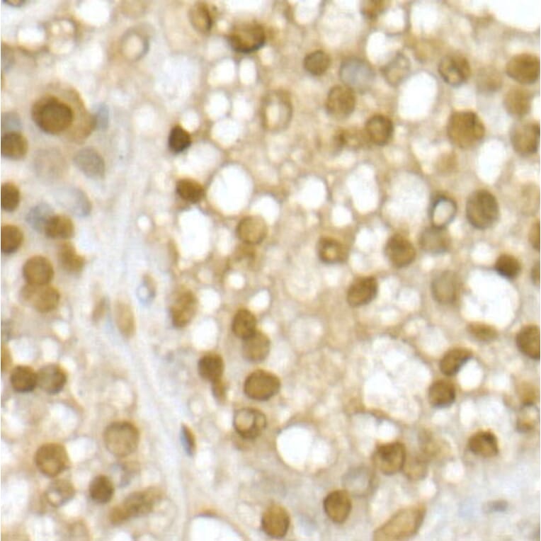 Immunohistochemistry - Anti-RING2/RING1B/RNF2 Antibody (A14844) - Antibodies.com