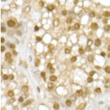 Immunohistochemistry - Anti-RING2/RING1B/RNF2 Antibody (A14844) - Antibodies.com