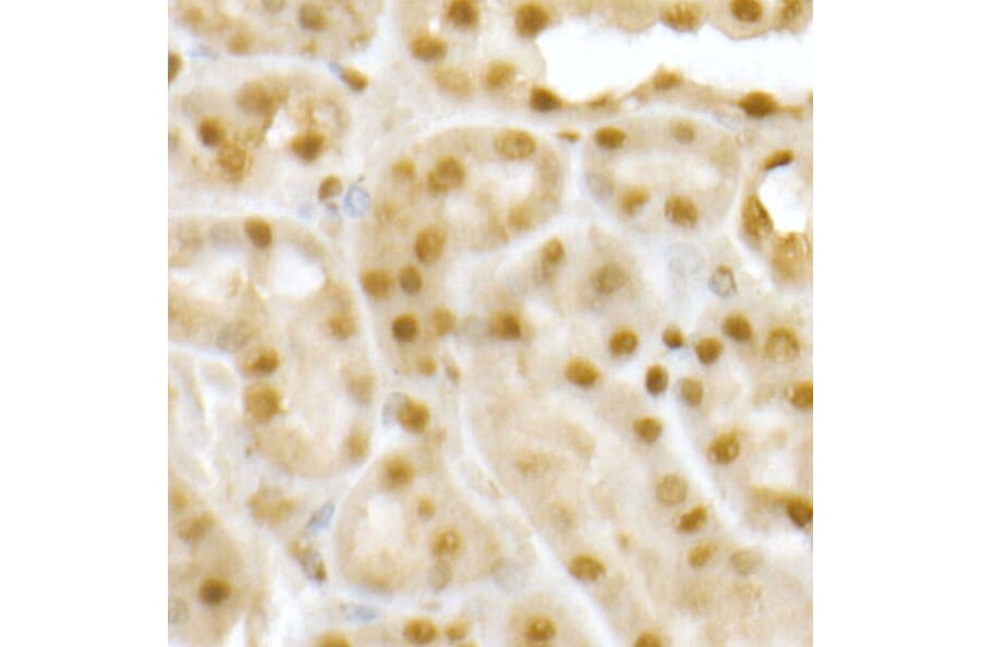 Immunohistochemistry - Anti-RING2/RING1B/RNF2 Antibody (A14844) - Antibodies.com