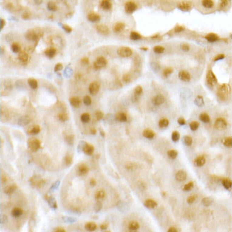 Immunohistochemistry - Anti-RING2/RING1B/RNF2 Antibody (A14844) - Antibodies.com