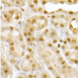 Immunohistochemistry - Anti-RING2/RING1B/RNF2 Antibody (A14844) - Antibodies.com
