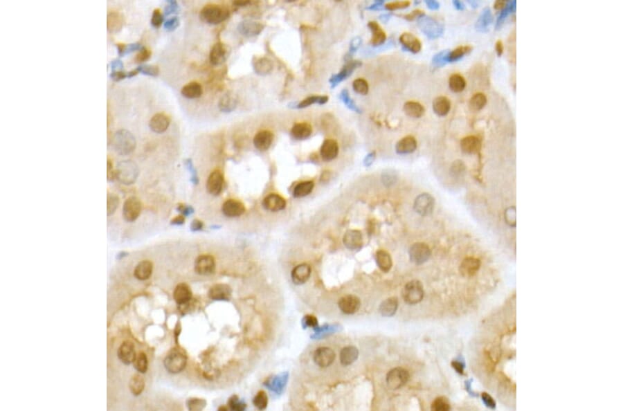 Immunohistochemistry - Anti-RING2/RING1B/RNF2 Antibody (A14844) - Antibodies.com