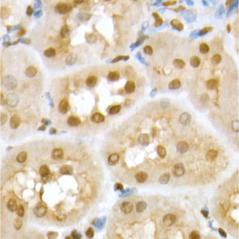 Immunohistochemistry - Anti-RING2/RING1B/RNF2 Antibody (A14844) - Antibodies.com