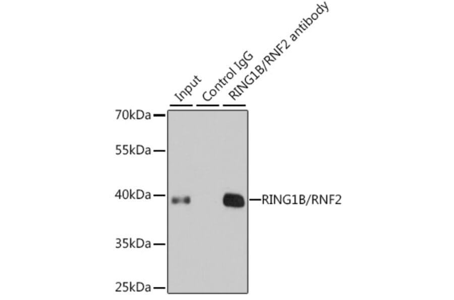 Western Blot - Anti-RING2/RING1B/RNF2 Antibody (A14844) - Antibodies.com