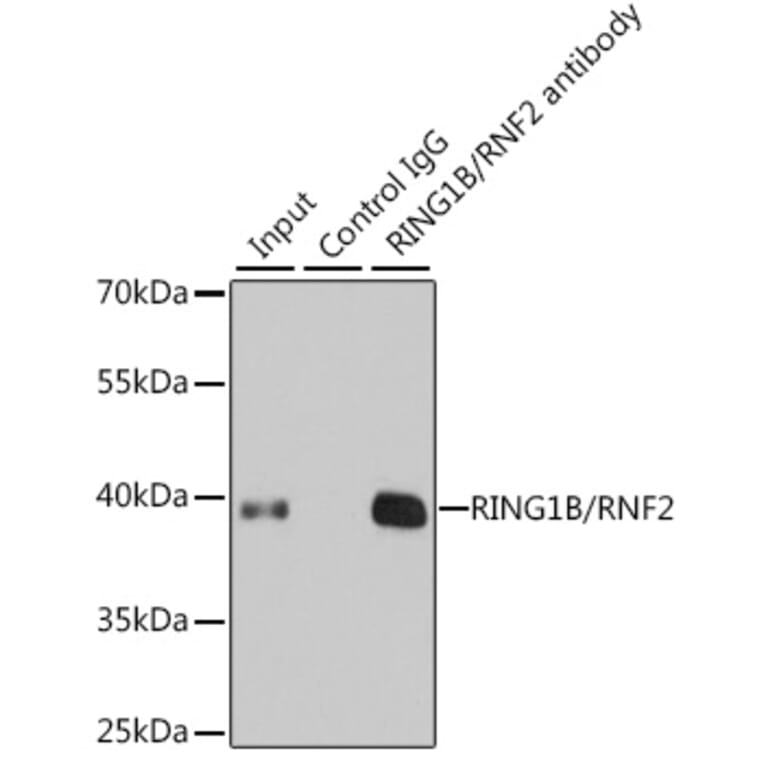 Western Blot - Anti-RING2/RING1B/RNF2 Antibody (A14844) - Antibodies.com