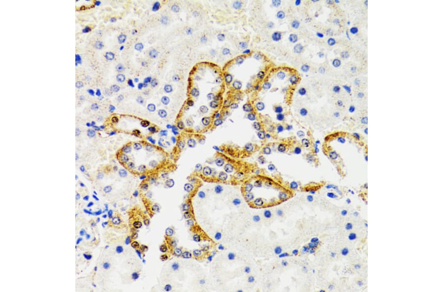 Immunohistochemistry - Anti-SH2B1/PSM Antibody (A14845) - Antibodies.com